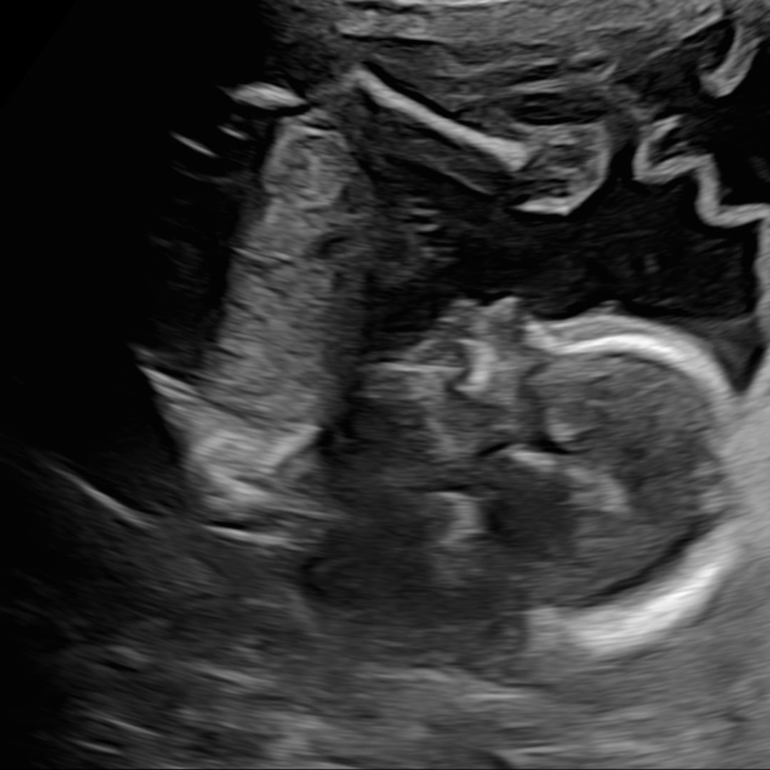 Photo shared by Heather for their Babylist baby registry.