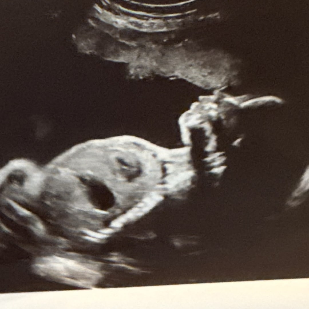 Photo shared by Kelly for their Babylist baby registry.