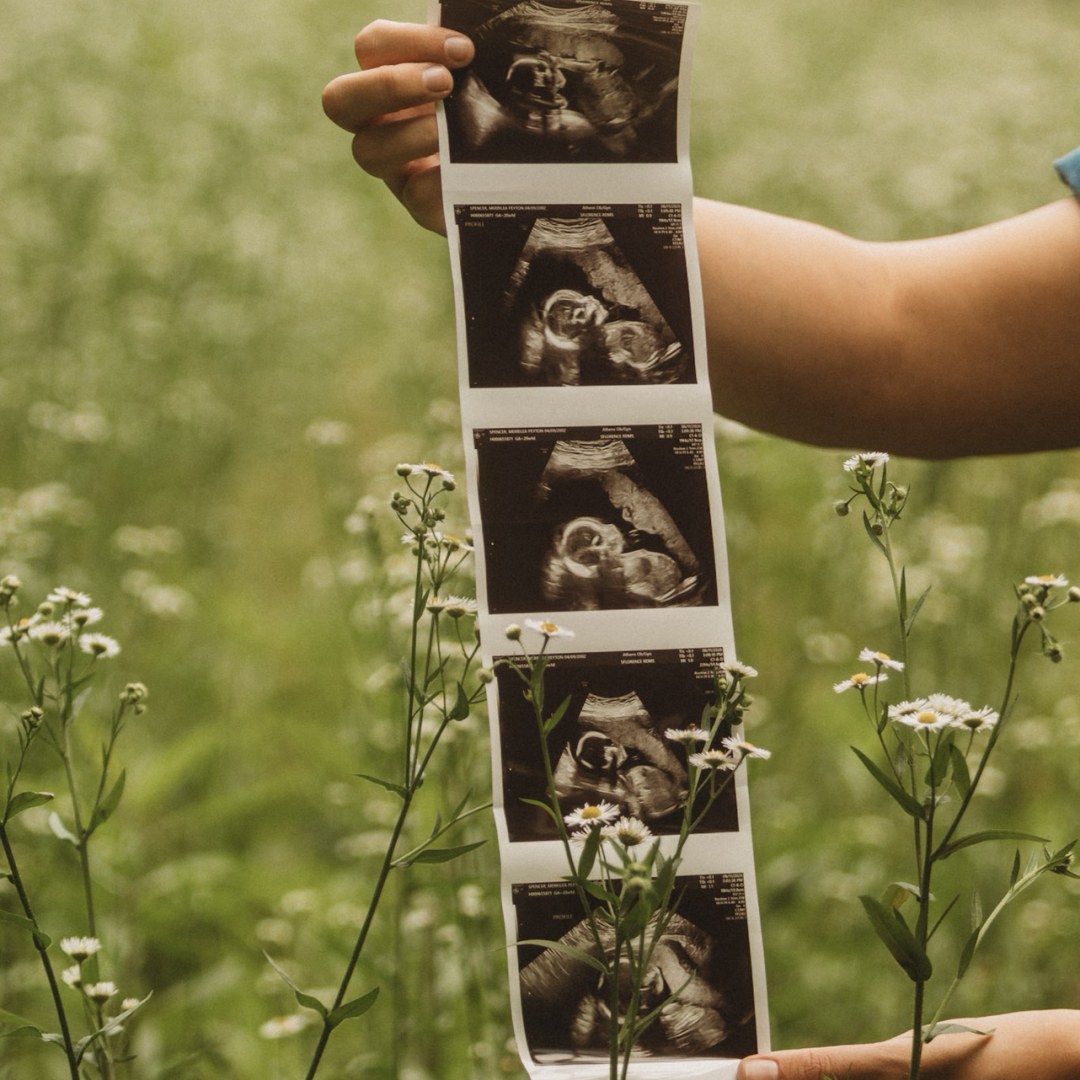 Photo shared by Peyton for their Babylist baby registry.