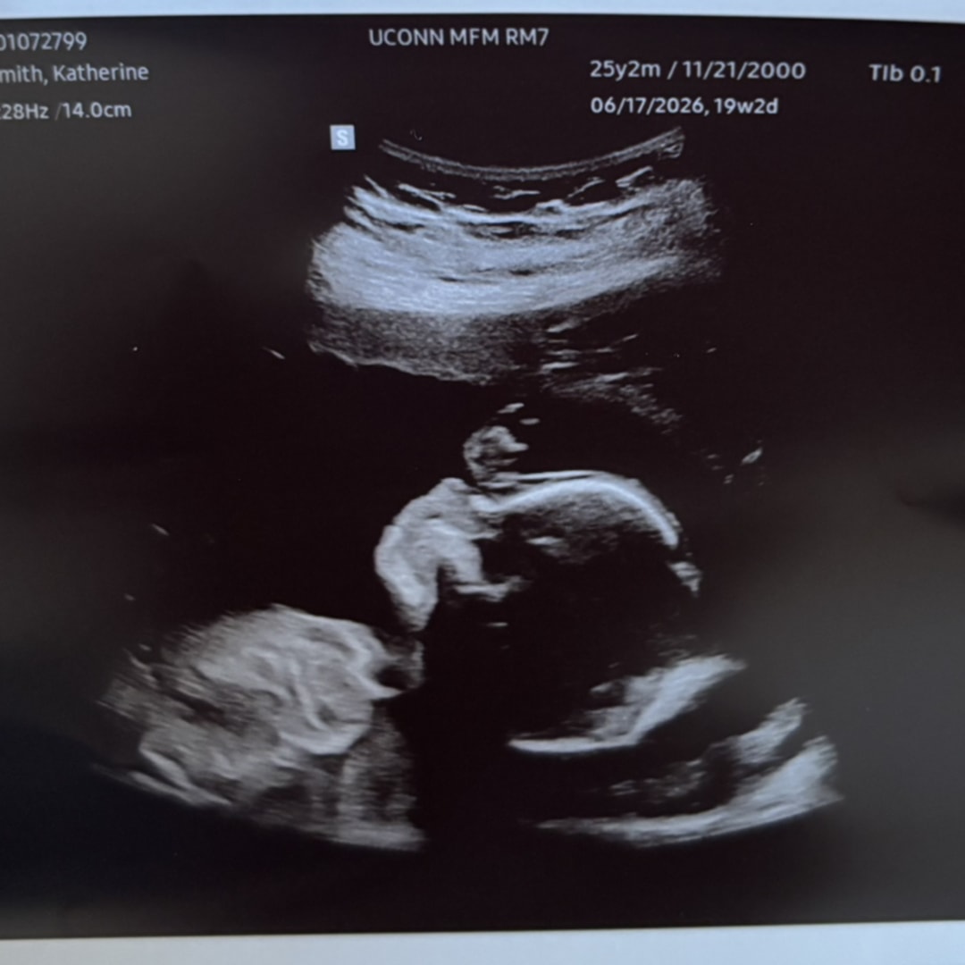 Photo shared by Katie for their Babylist baby registry.