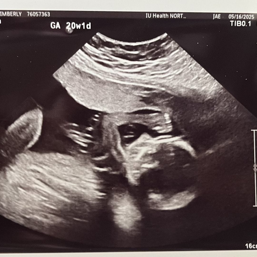 Photo shared by Kimberly for their Babylist baby registry.