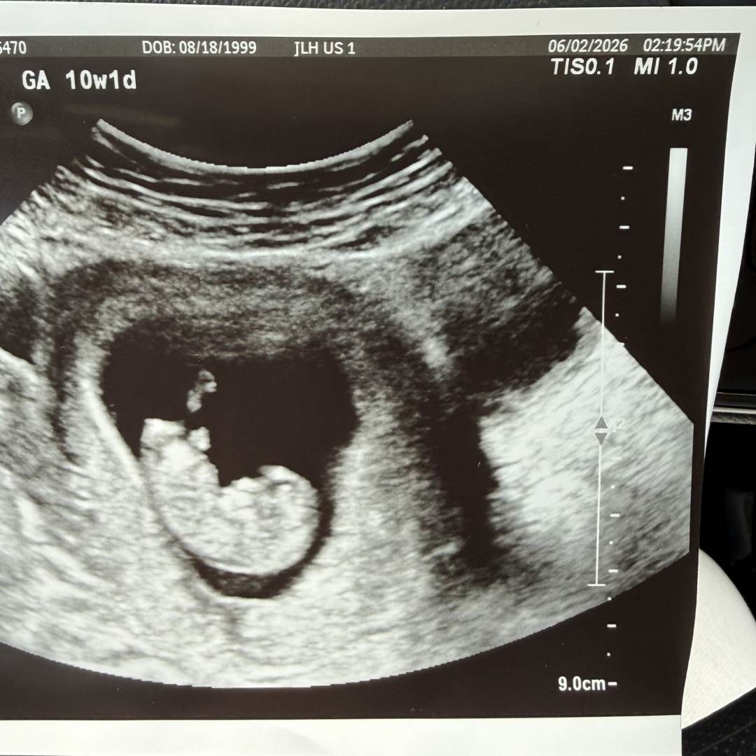 Photo shared by Makayla for their Babylist baby registry.