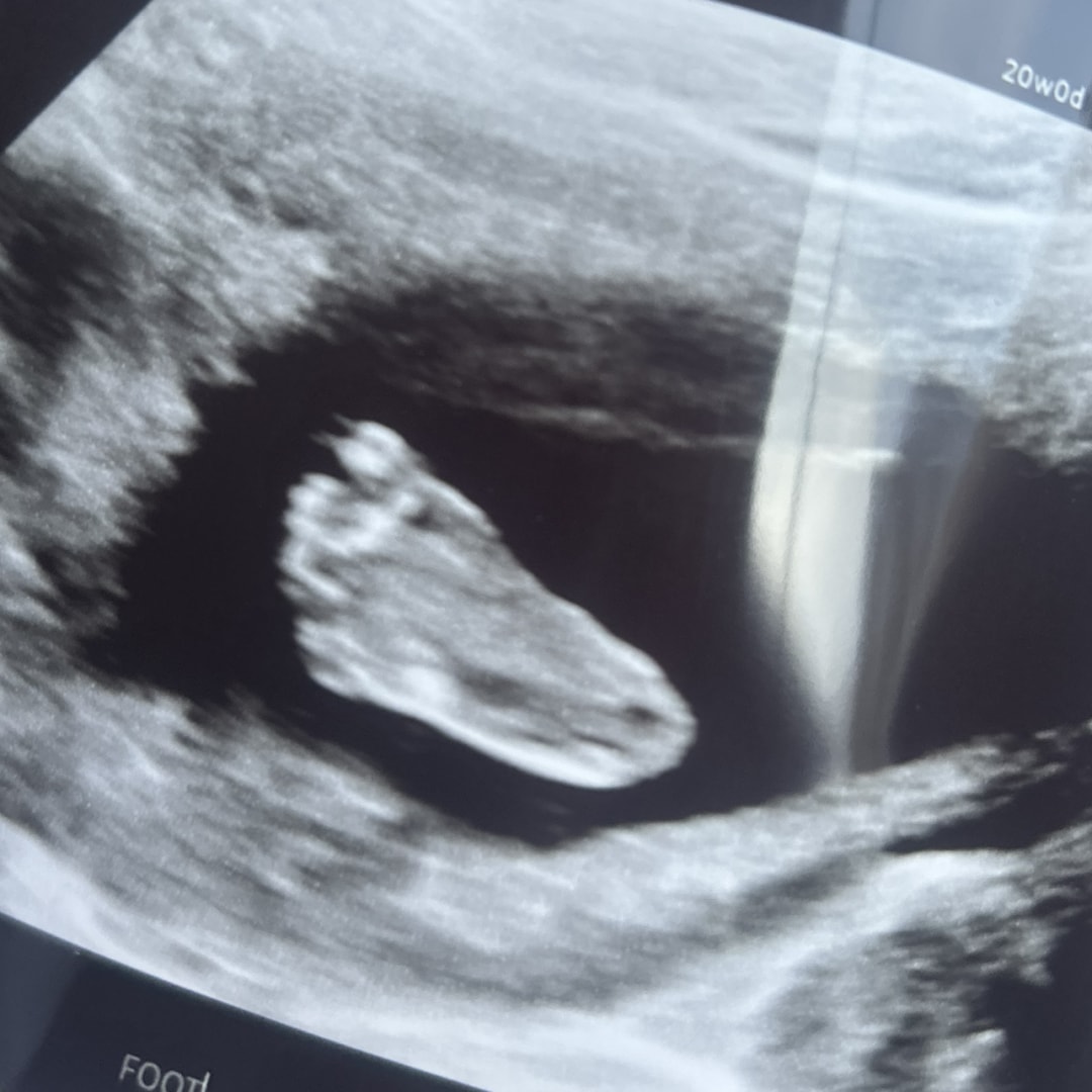 Photo shared by Chloe for their Babylist baby registry.