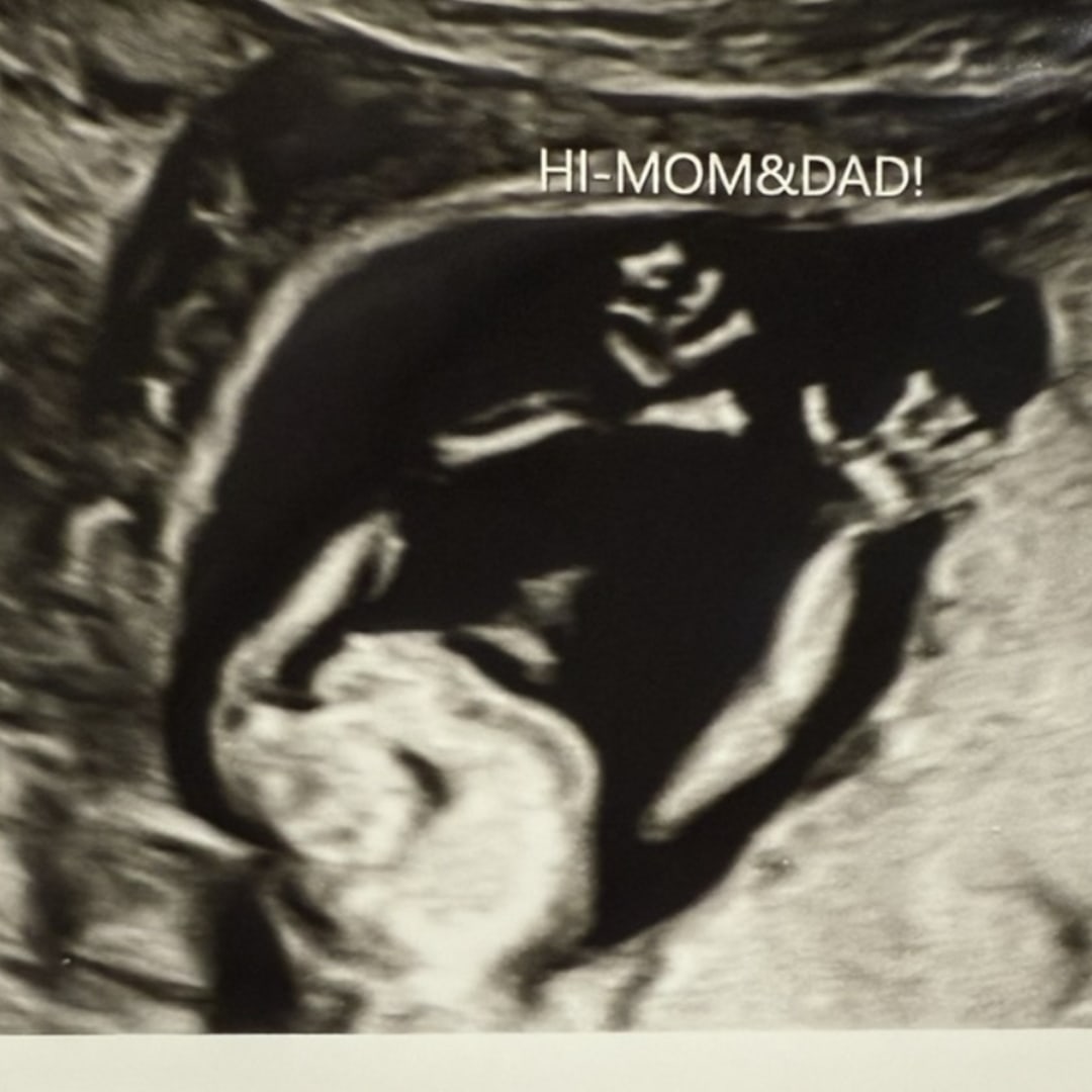 Photo shared by Brittany for their Babylist baby registry.