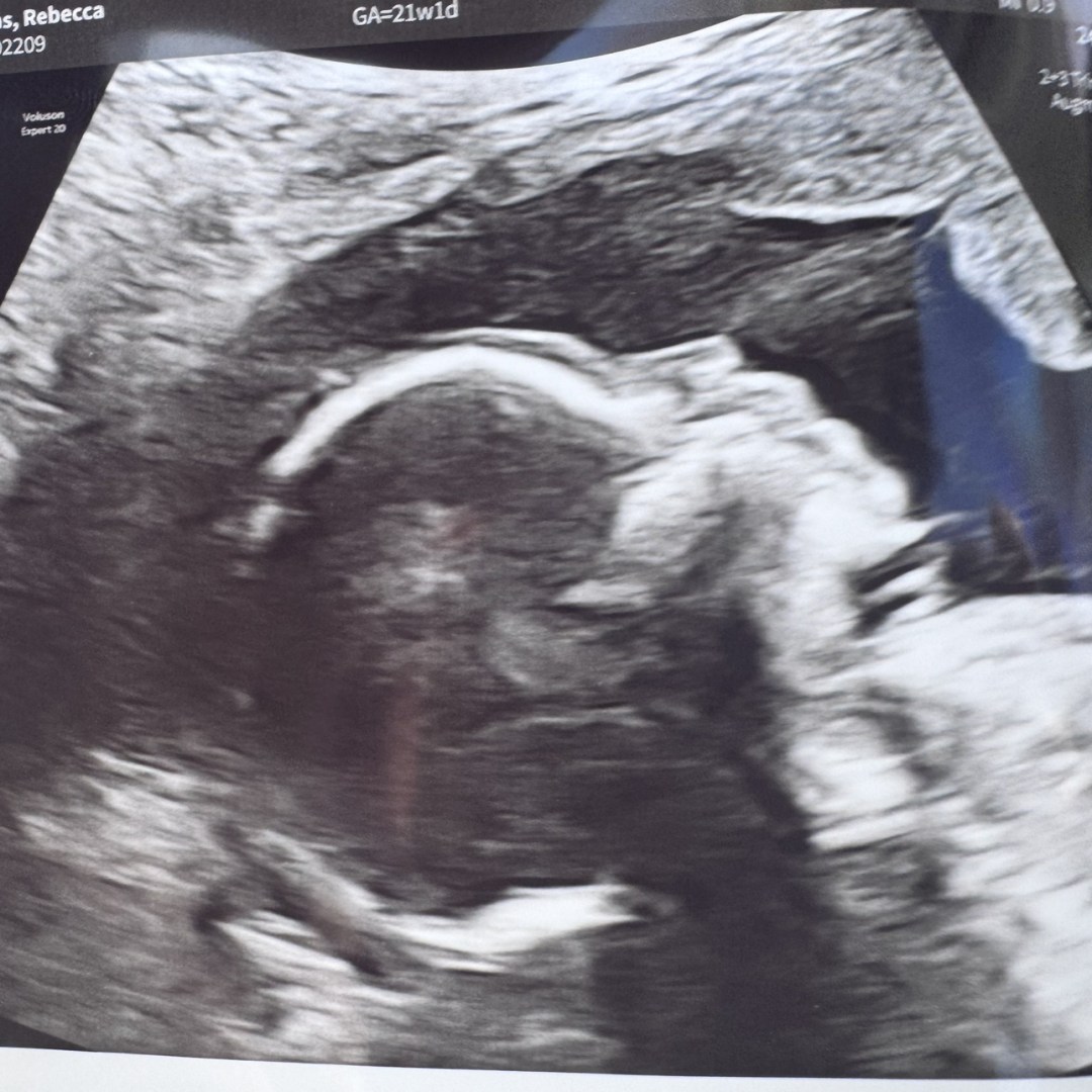 Photo shared by Rebecca for their Babylist baby registry.
