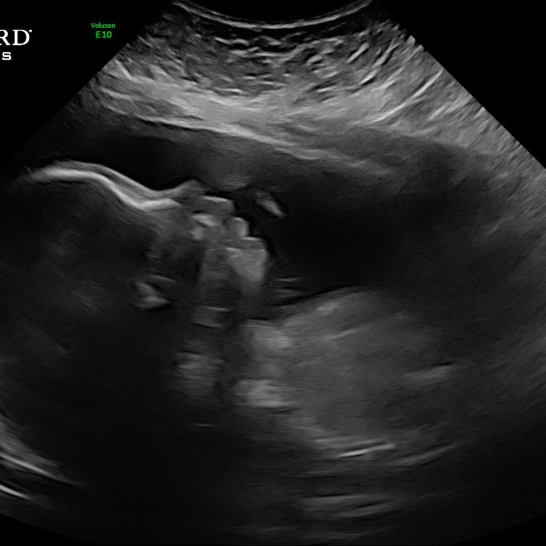 Photo shared by Brittin for their Babylist baby registry.