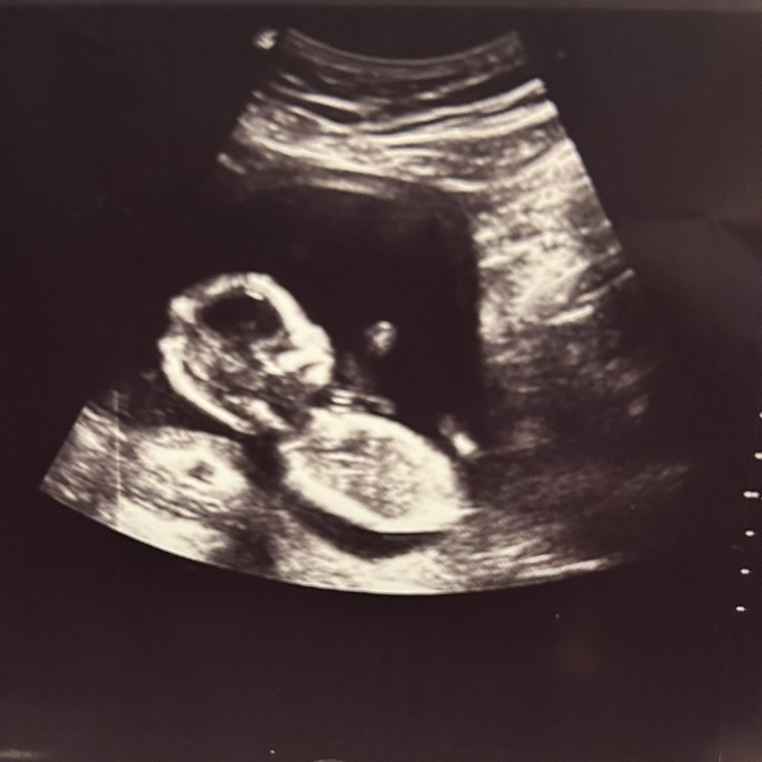 Photo shared by Jenevieve for their Babylist baby registry.