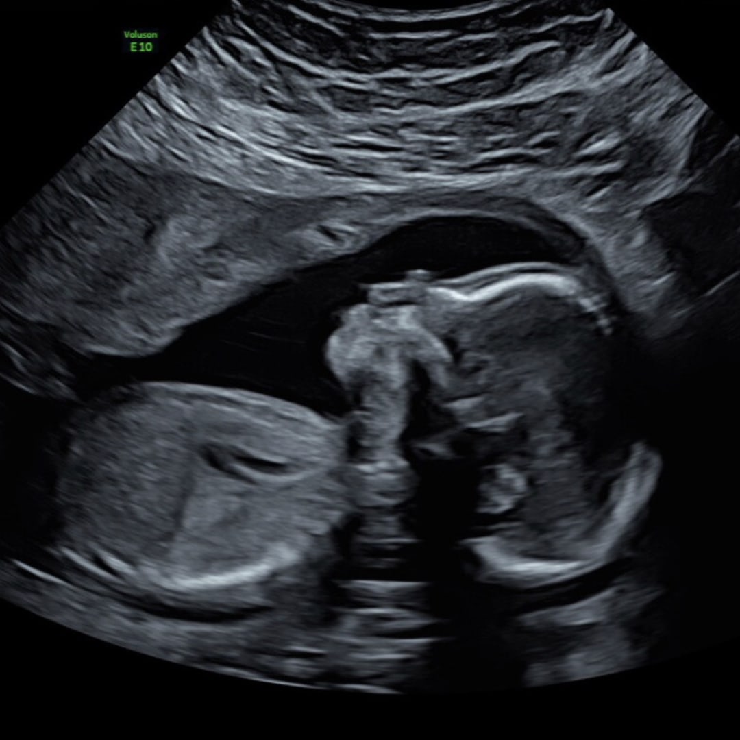 Photo shared by Chantelle for their Babylist baby registry.