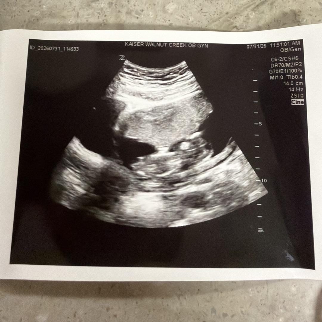 Photo shared by Marie for their Babylist baby registry.