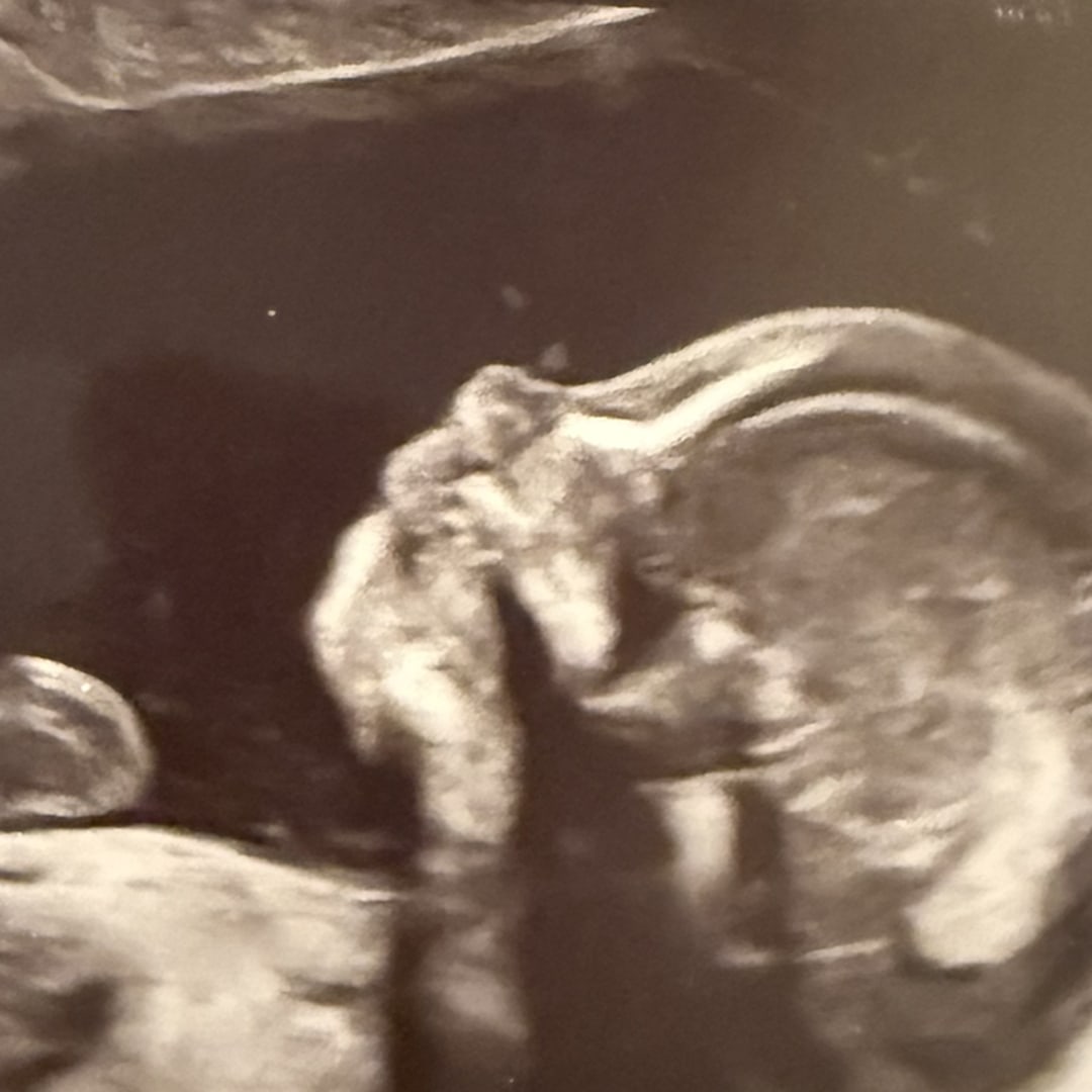 Photo shared by Rachel for their Babylist baby registry.