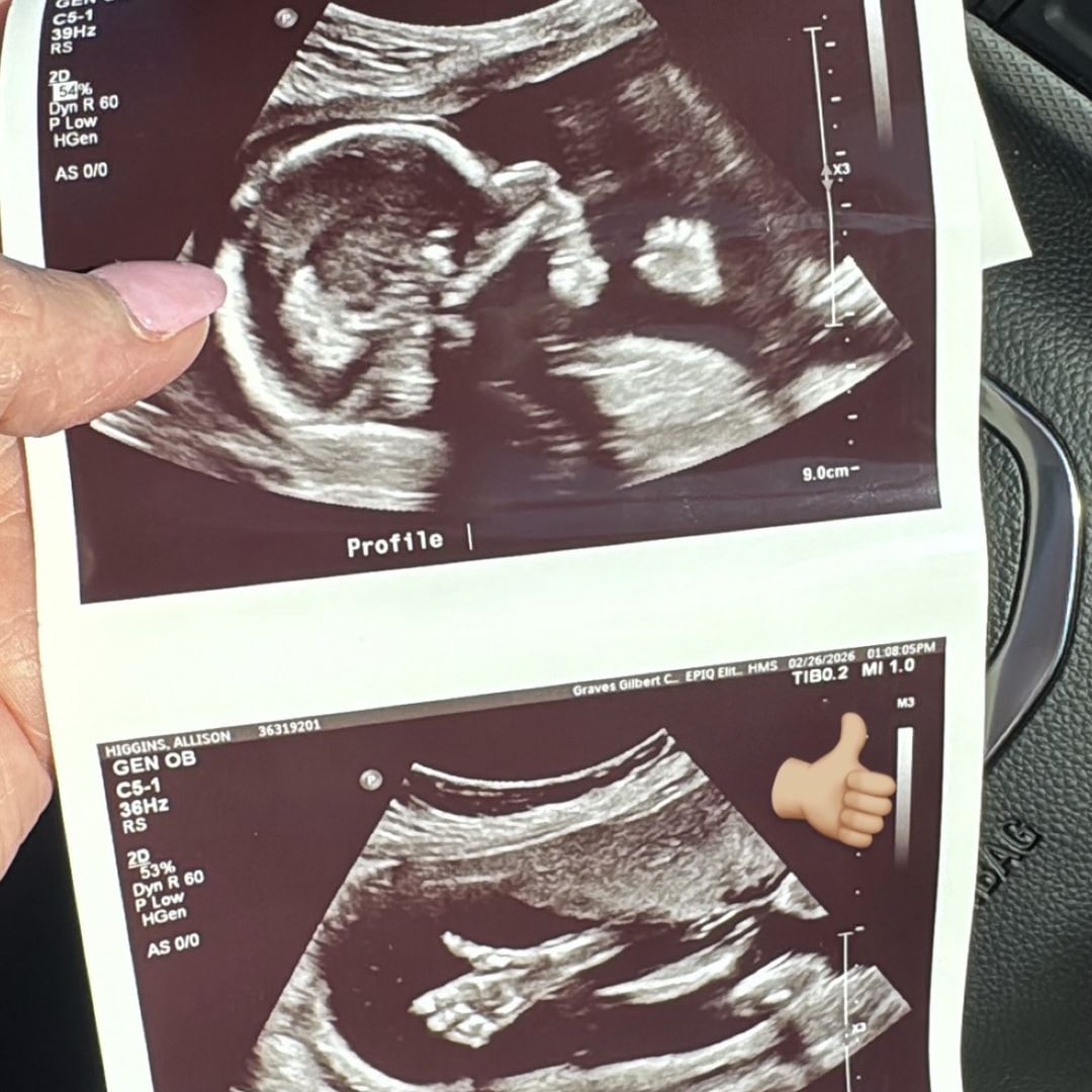 Photo shared by Allison for their Babylist baby registry.