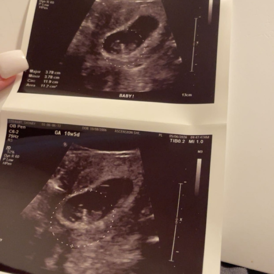Photo shared by Sydney for their Babylist baby registry.