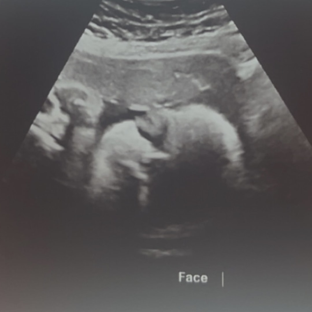Photo shared by Taylor for their Babylist baby registry.