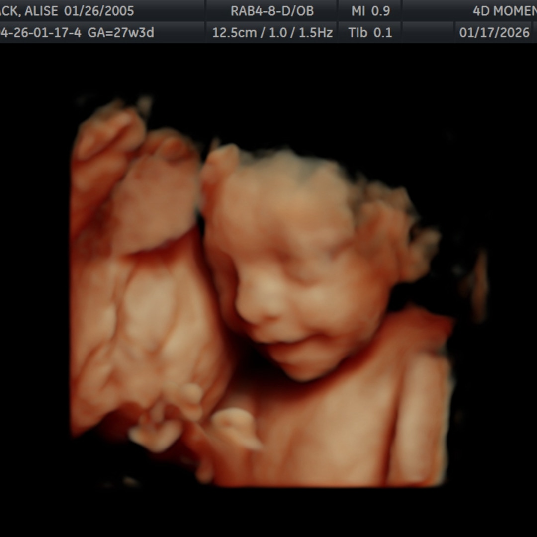 Photo shared by Kole for their Babylist baby registry.