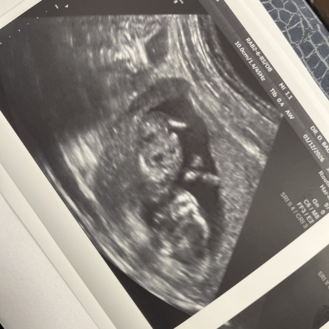 Photo shared by Erykah for their Babylist baby registry.