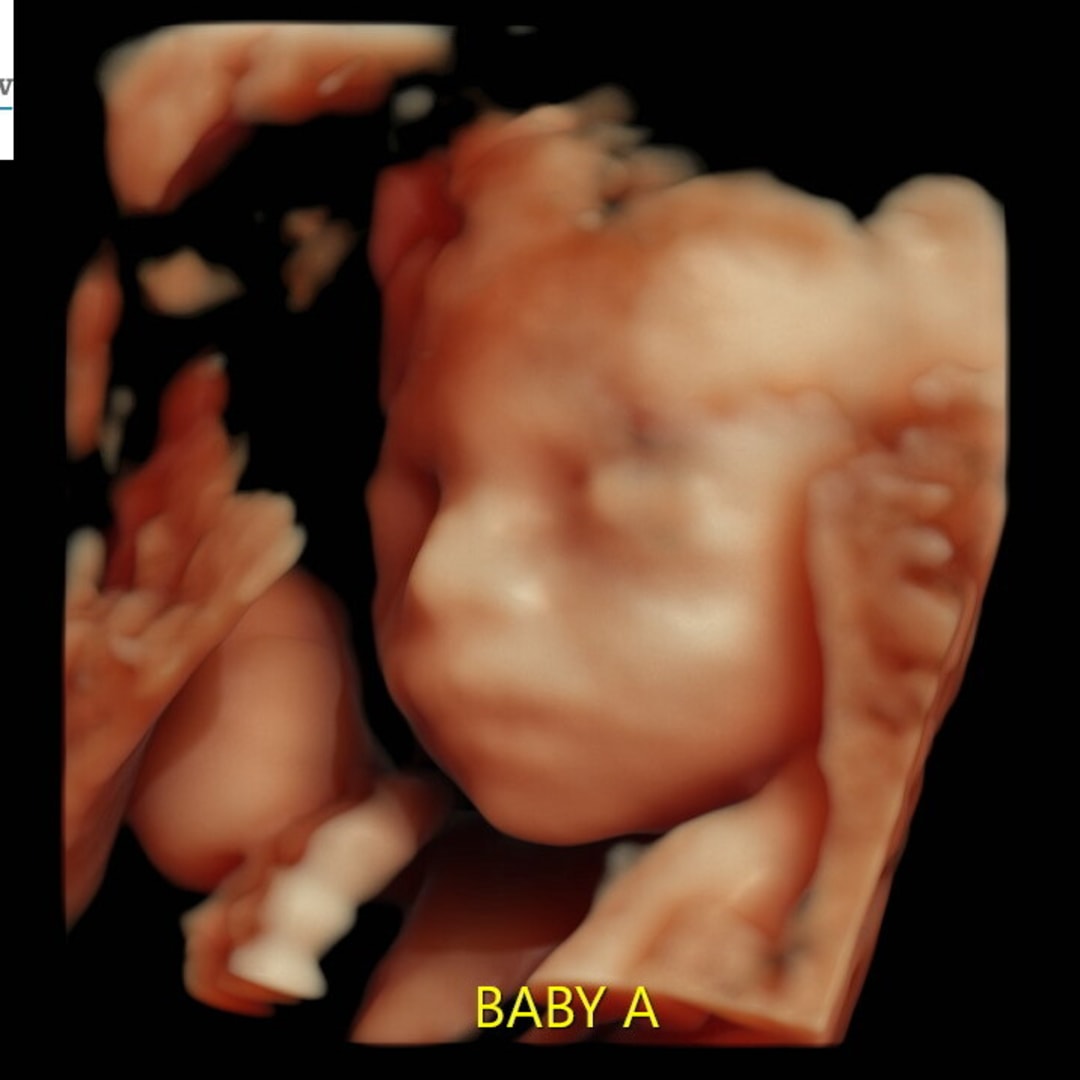 Photo shared by Brooke for their Babylist baby registry.