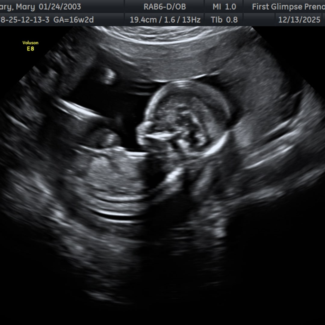 Photo shared by Mary for their Babylist baby registry.