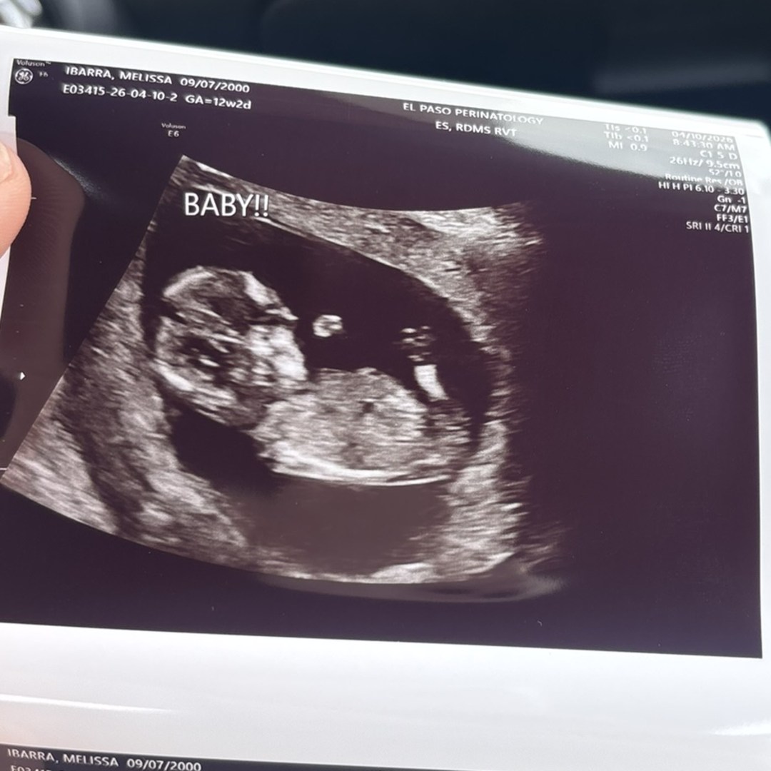 Photo shared by Melissa for their Babylist baby registry.