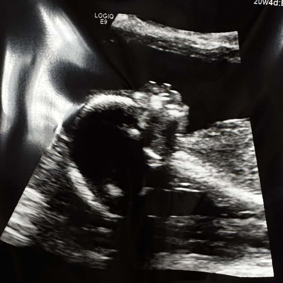 Photo shared by Sierra for their Babylist baby registry.