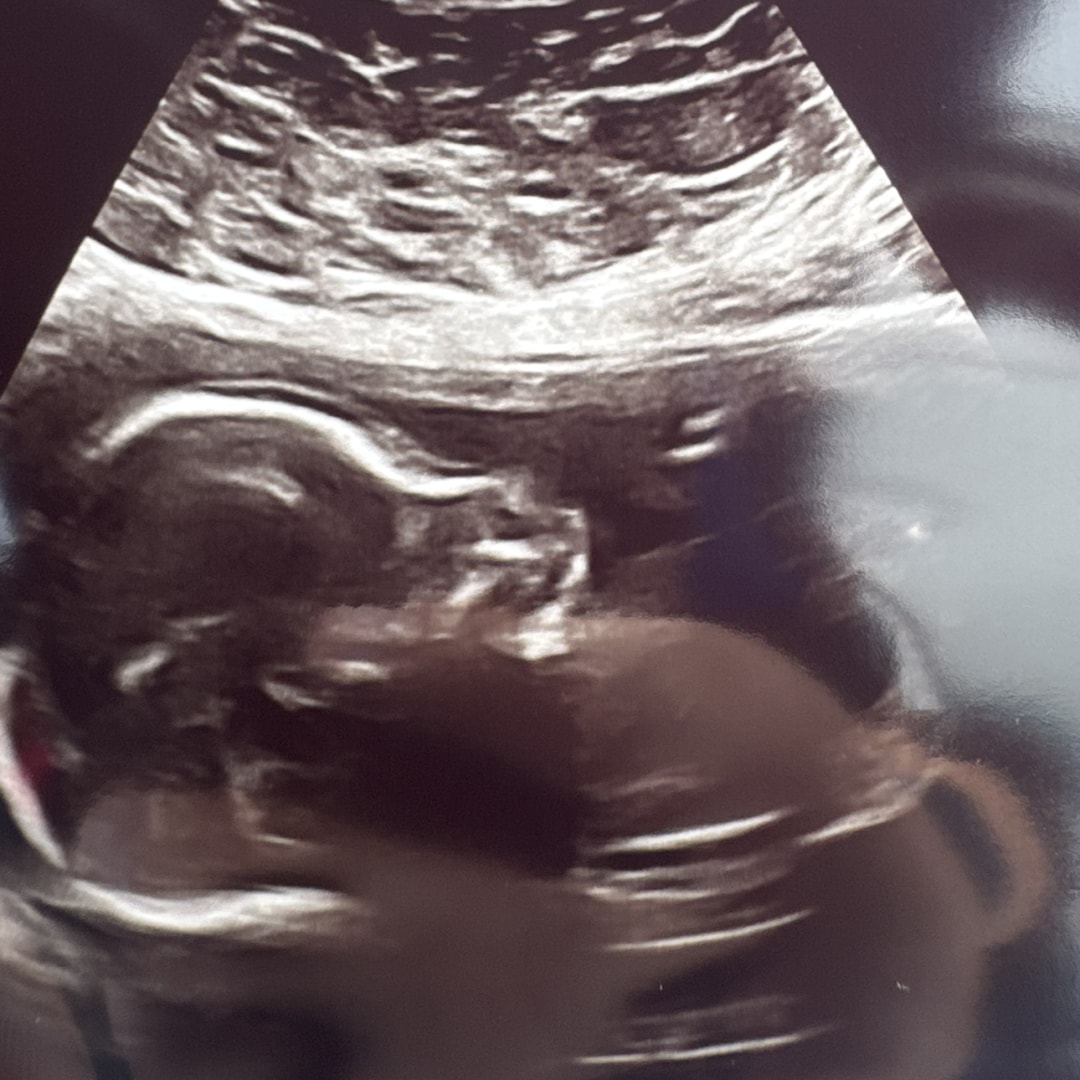 Photo shared by Stephanie for their Babylist baby registry.