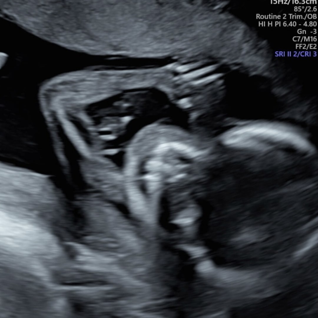 Photo shared by Kayla for their Babylist baby registry.