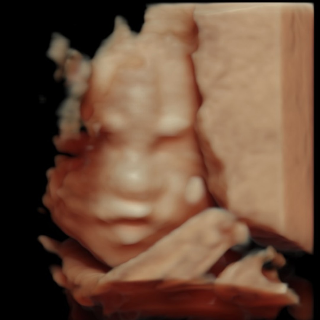 Photo shared by Maibelyn for their Babylist baby registry.
