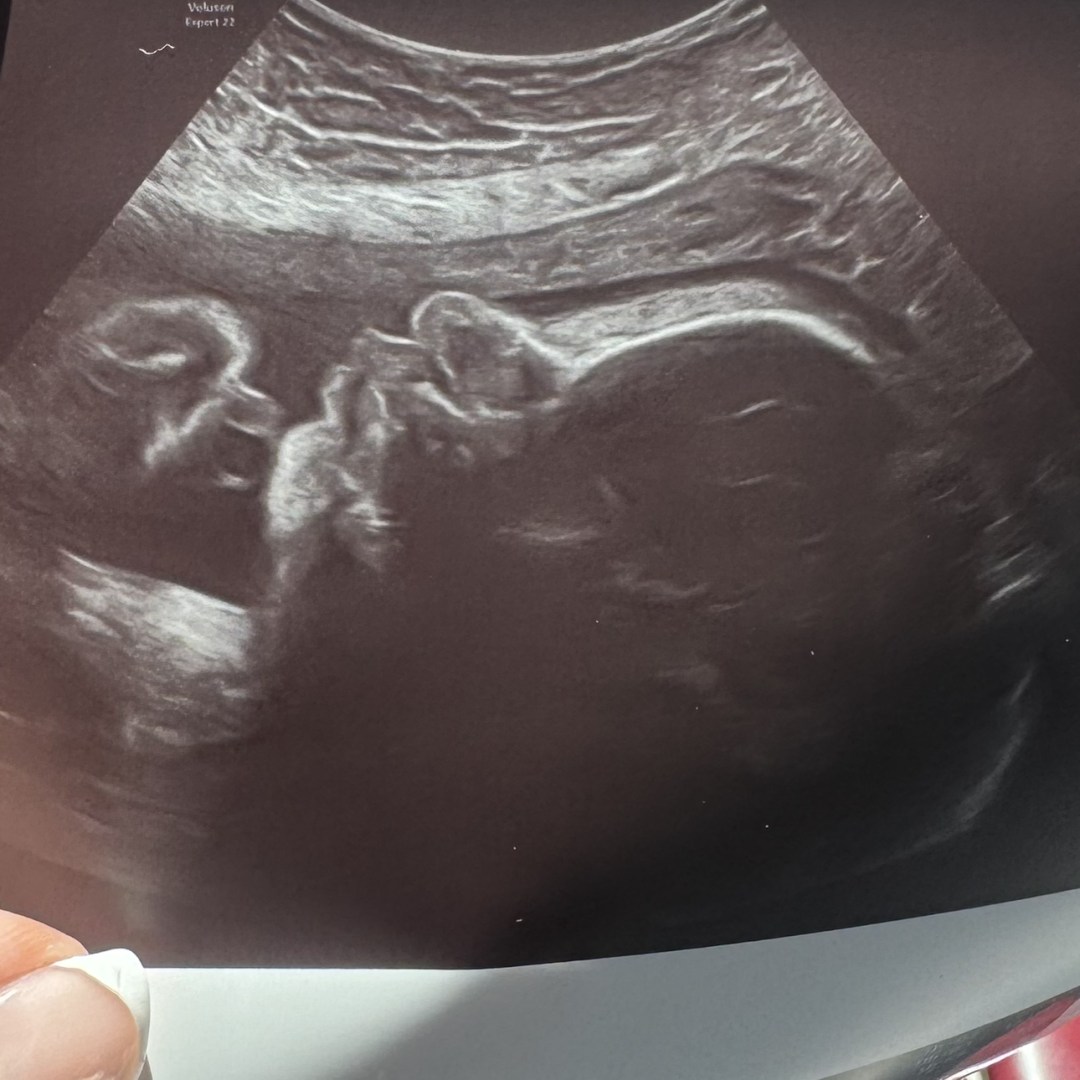 Photo shared by Karen for their Babylist baby registry.