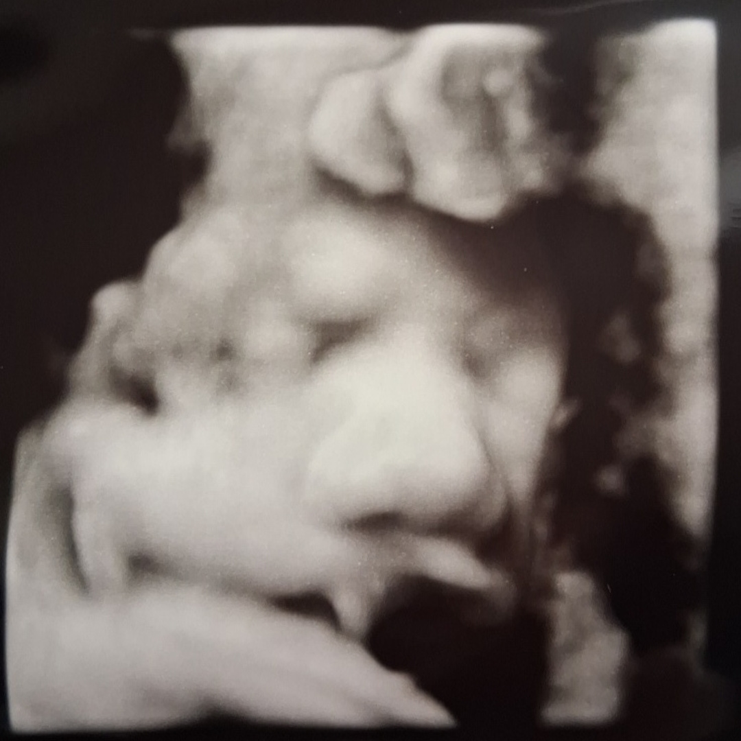 Photo shared by Candra for their Babylist baby registry.