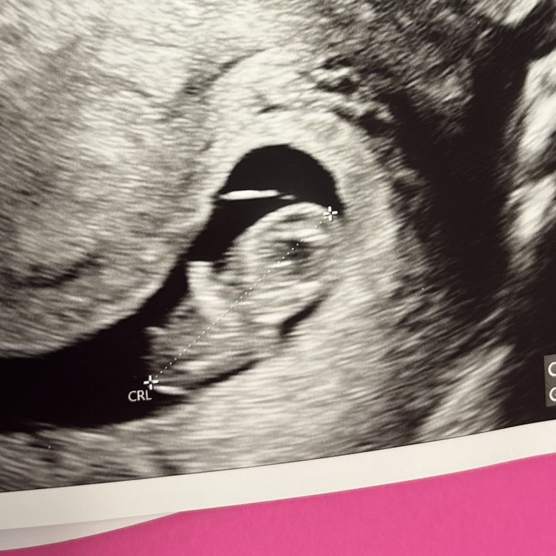 Photo shared by Katie for their Babylist baby registry.