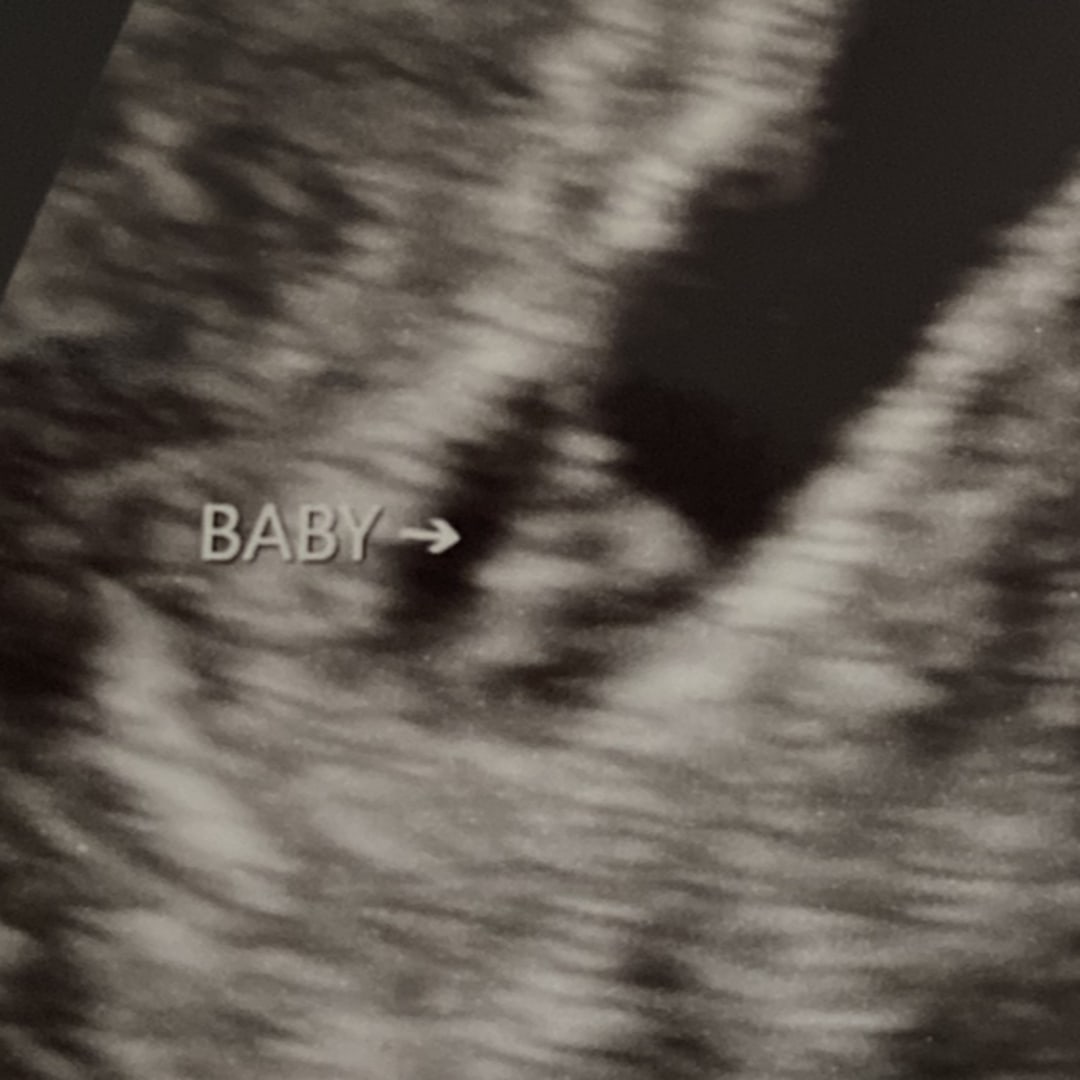 Photo shared by Tijanae for their Babylist baby registry.