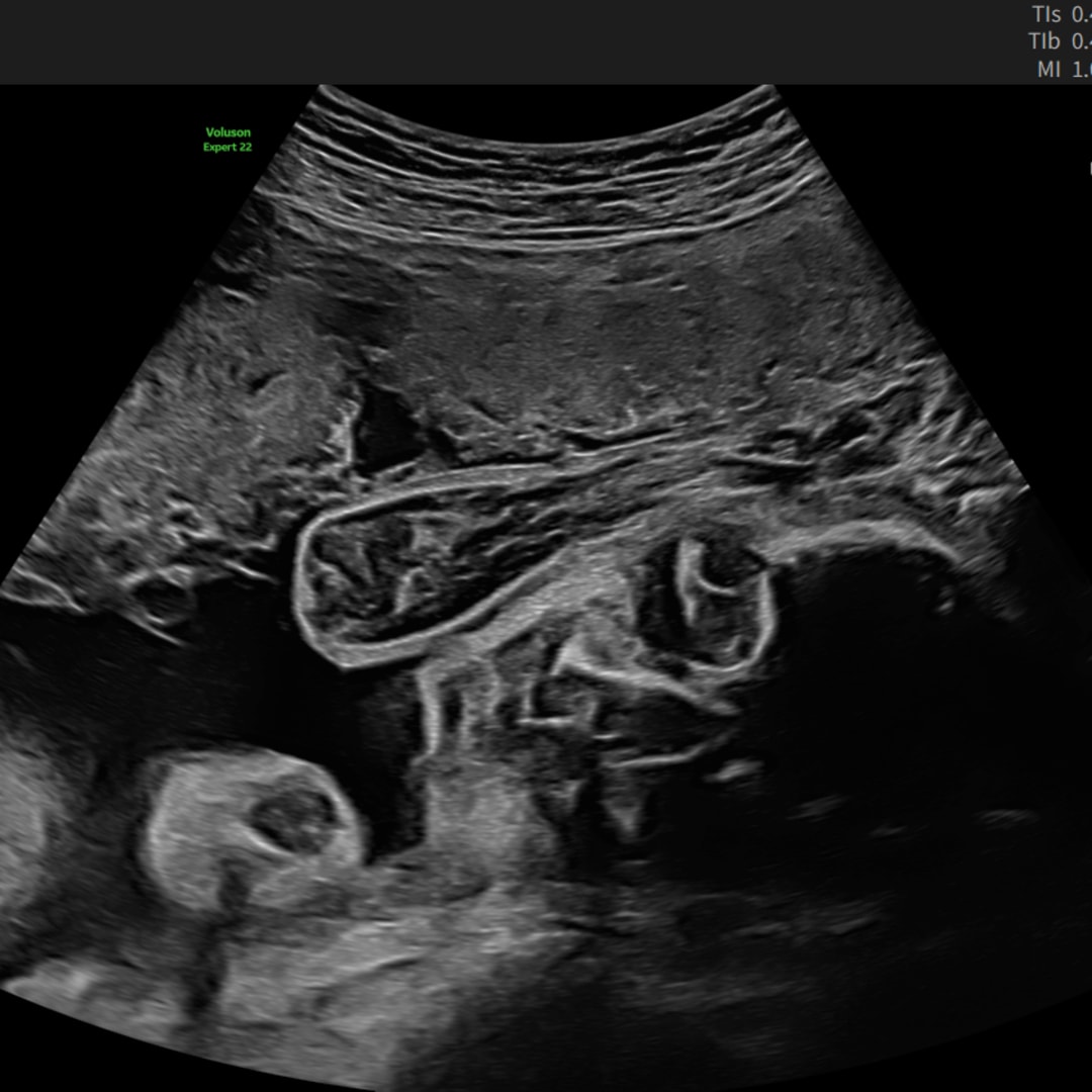 Photo shared by Hannah for their Babylist baby registry.
