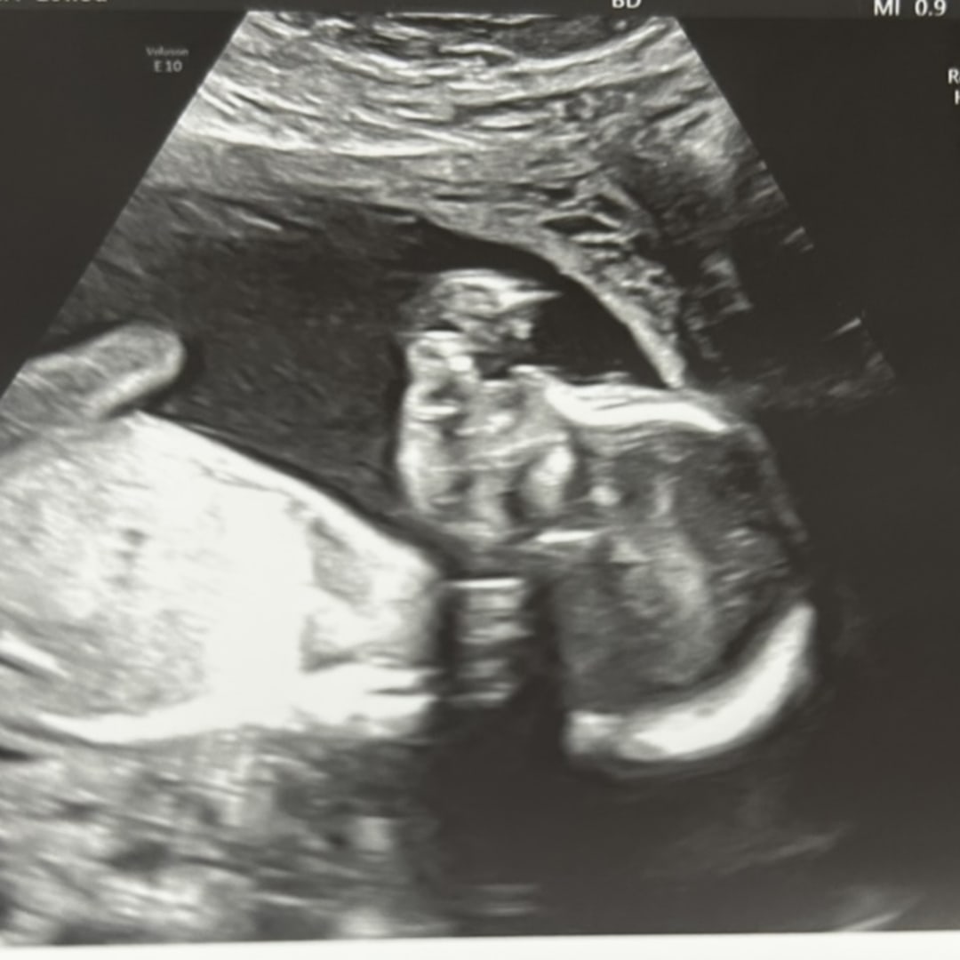 Photo shared by Reyna for their Babylist baby registry.