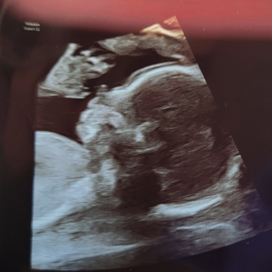 Photo shared by Marissa for their Babylist baby registry.