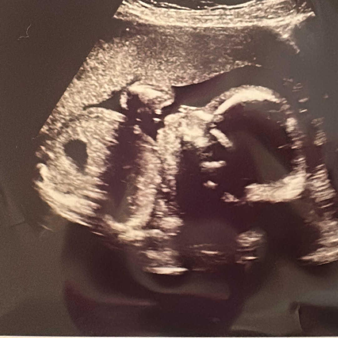 Photo shared by Zoe for their Babylist baby registry.