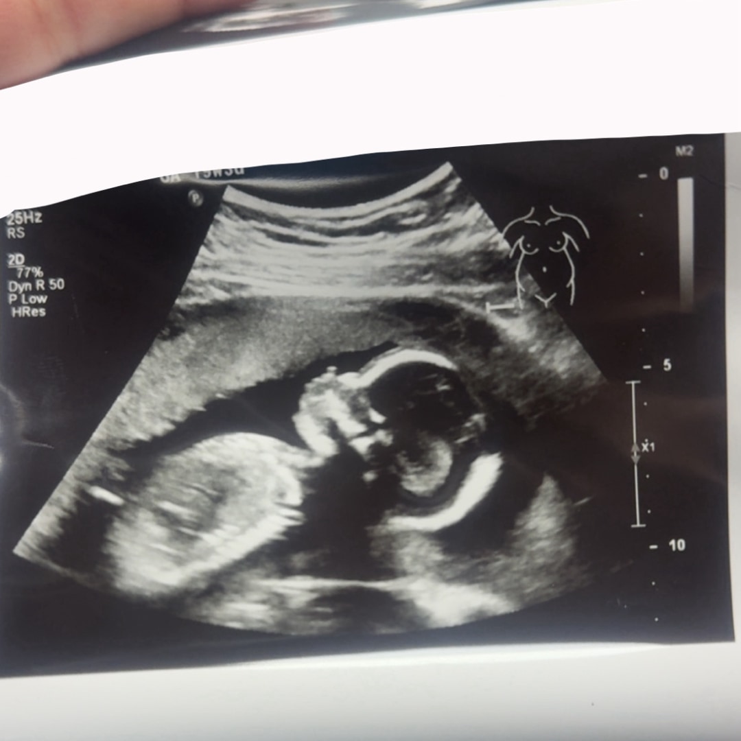 Photo shared by Lindsay for their Babylist baby registry.