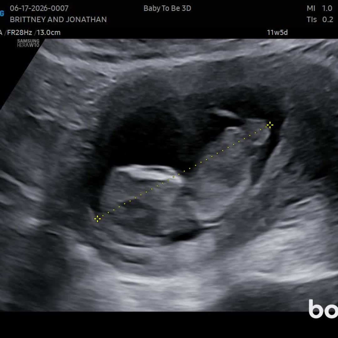 Photo shared by Brittney for their Babylist baby registry.