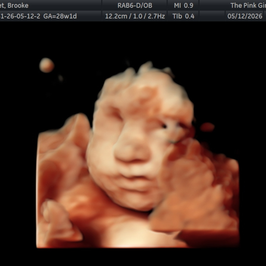 Photo shared by Brooke for their Babylist baby registry.