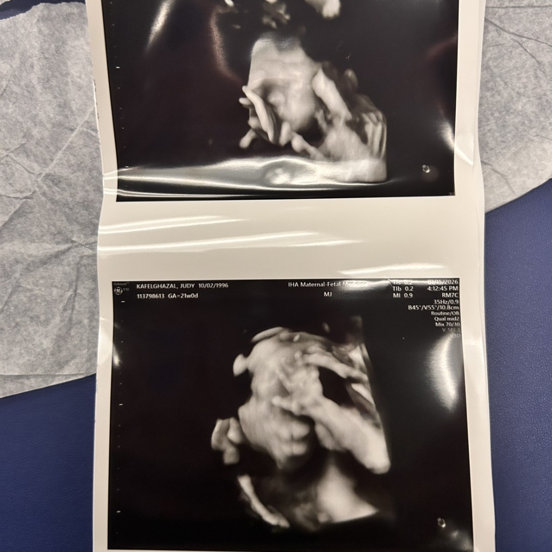 Photo shared by Judy for their Babylist baby registry.