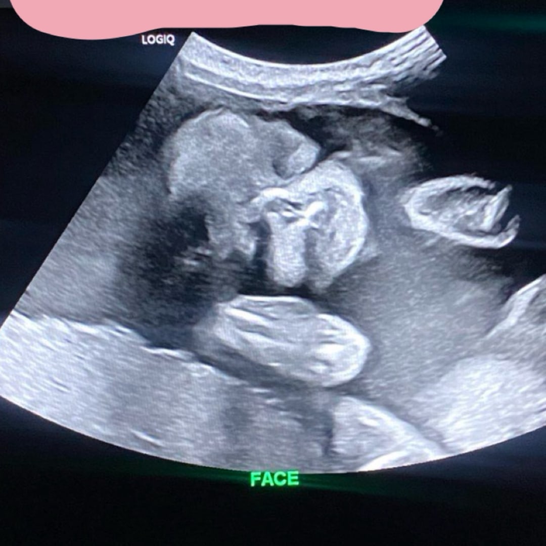 Photo shared by Aaliyha for their Babylist baby registry.