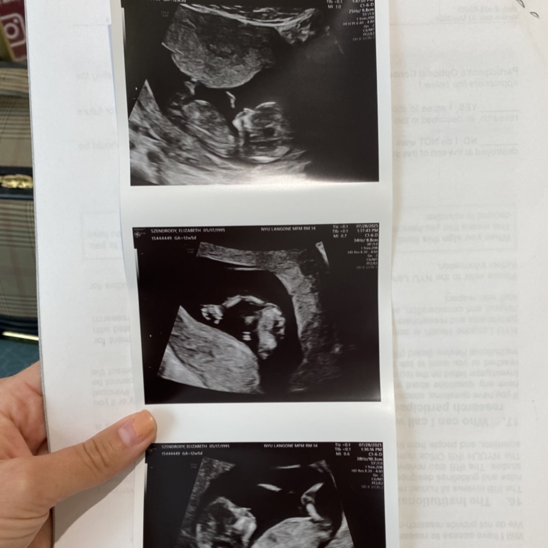 Photo shared by Elizabeth for their Babylist baby registry.