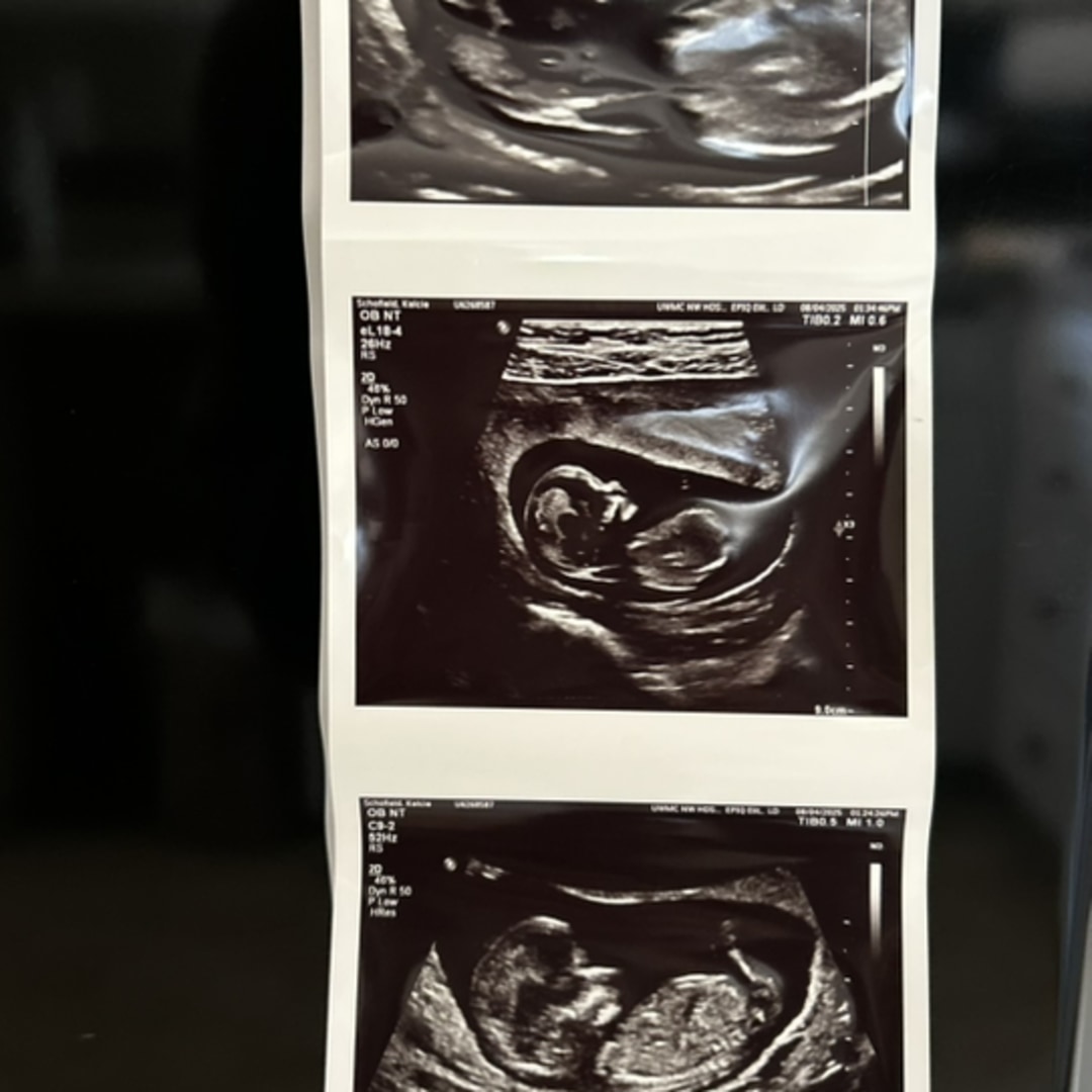 Photo shared by Kelcie for their Babylist baby registry.