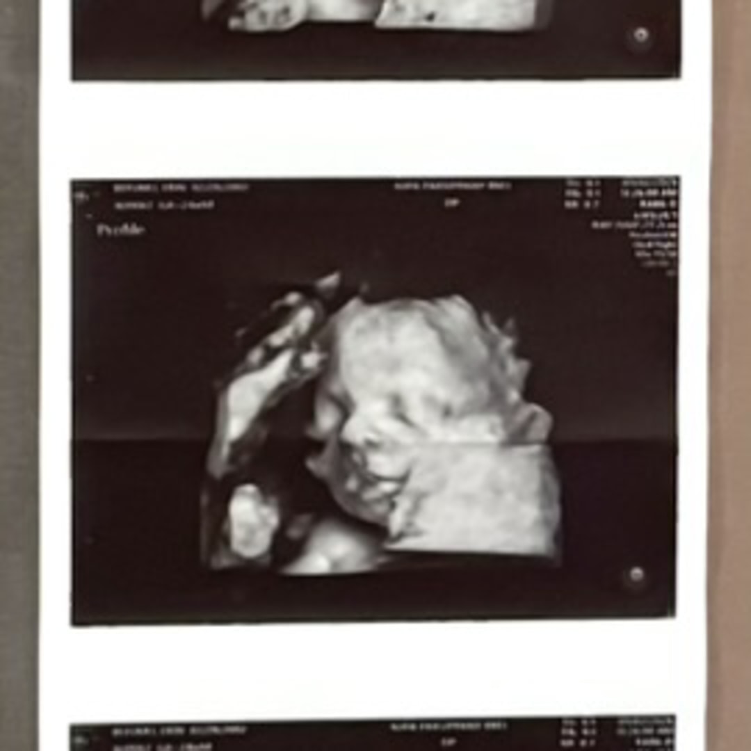Photo shared by Erin for their Babylist baby registry.