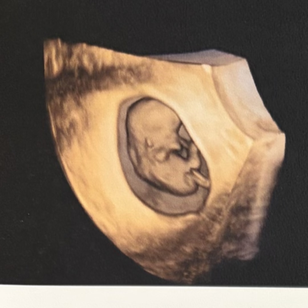 Photo shared by Casie for their Babylist baby registry.