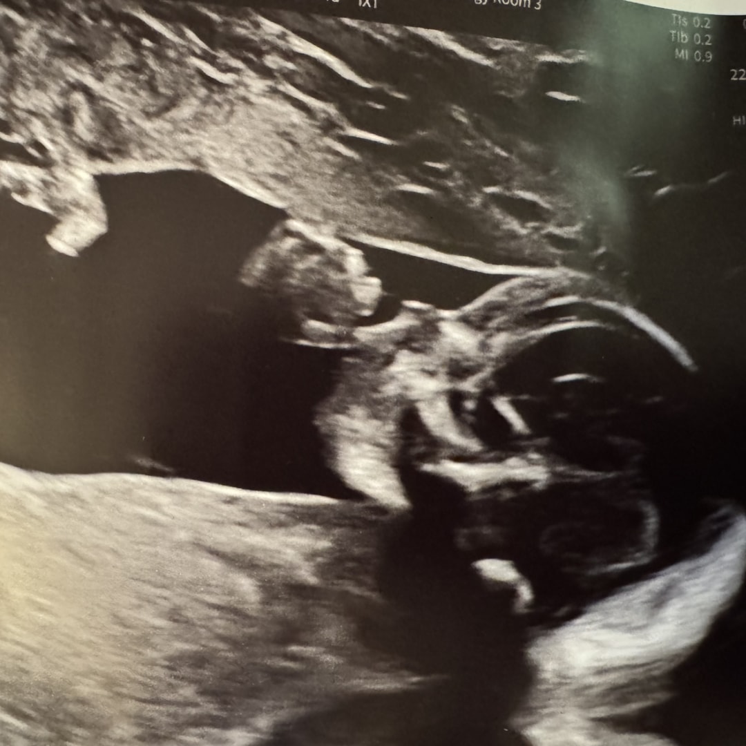 Photo shared by Rachel for their Babylist baby registry.