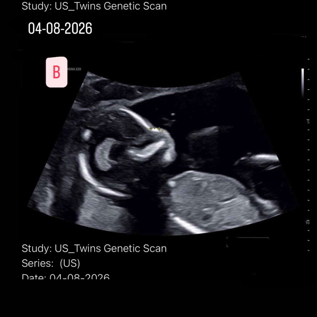 Photo shared by Patricia for their Babylist baby registry.