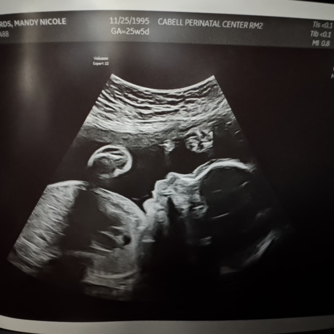 Photo shared by Mandy for their Babylist baby registry.