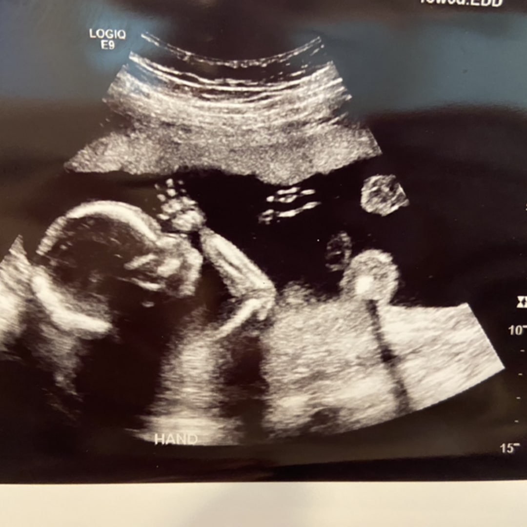 Photo shared by Tesia for their Babylist baby registry.