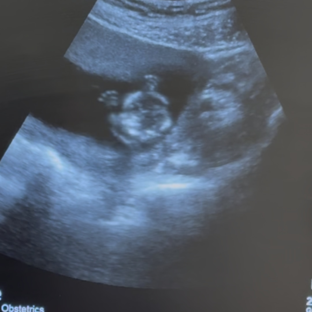 Photo shared by Catherine for their Babylist baby registry.