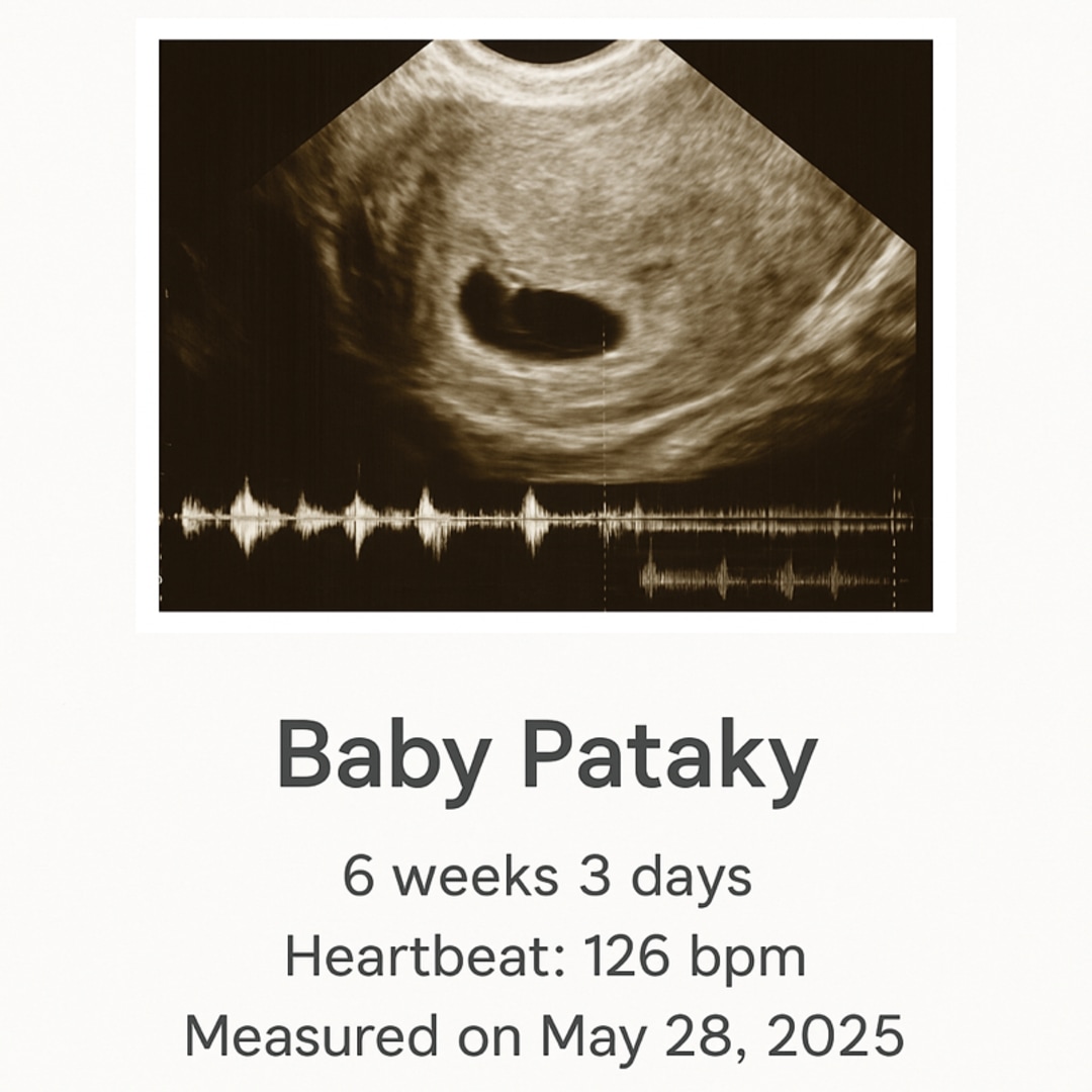 Photo shared by Chelsea for their Babylist baby registry.