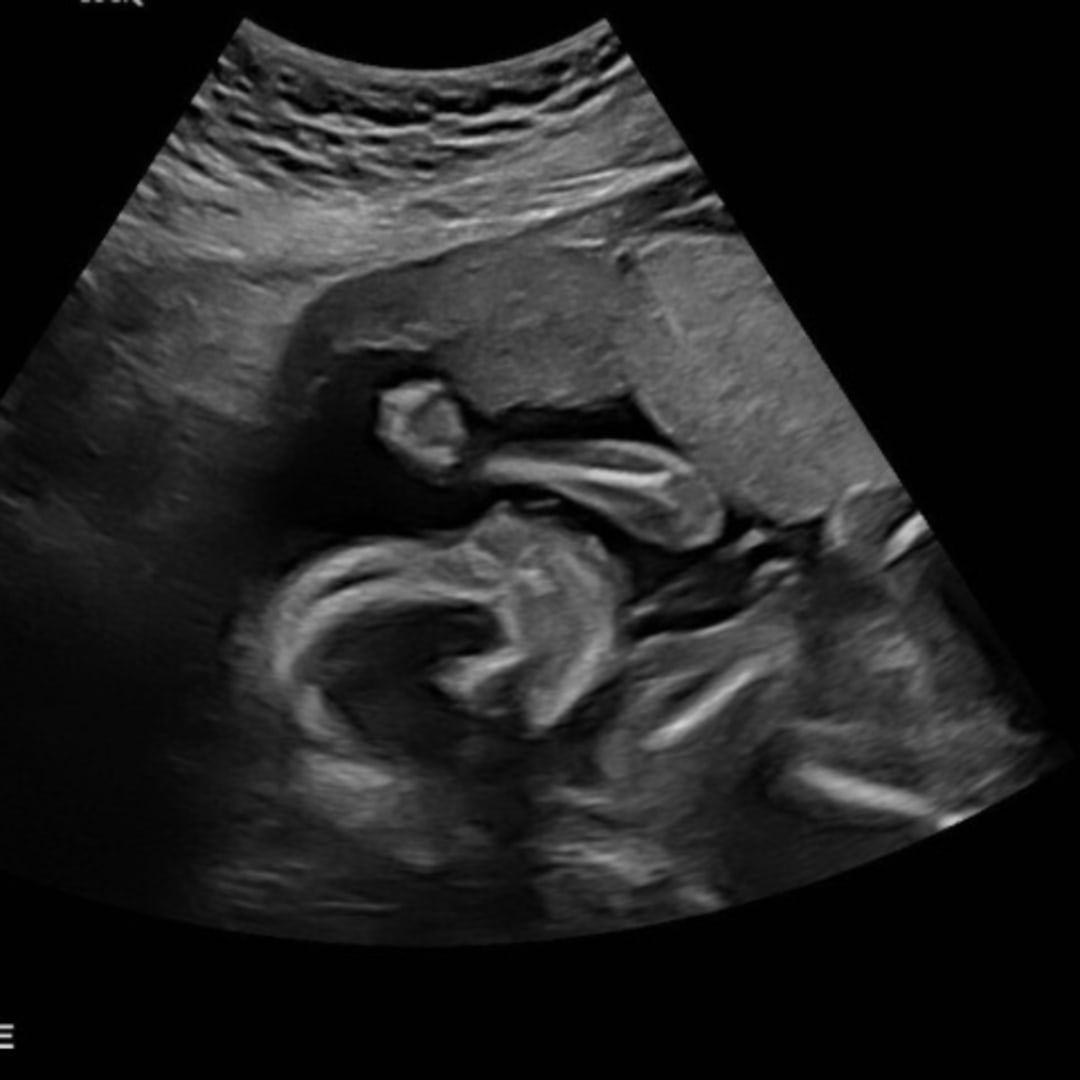Photo shared by Scotlyn for their Babylist baby registry.